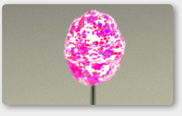Splatter